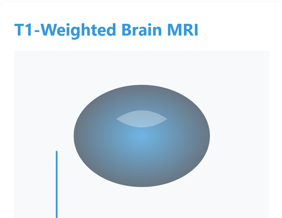 T1-Weighted Brain MRI
