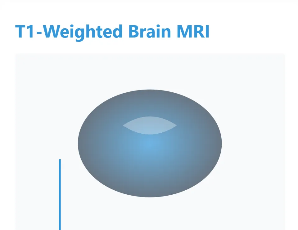 MRI Scan Types: The Secret Weapon Behind Accurate Diagnoses 2 T1-Weighted Brain MRI