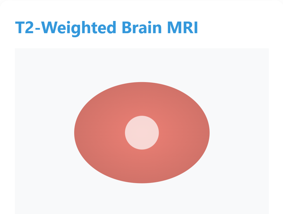 T2-Weighted Brain MRI
