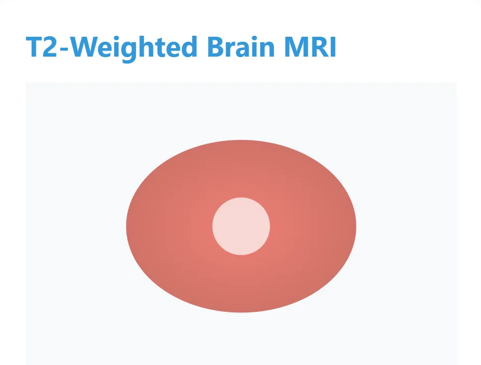 MRI Scan Types: The Secret Weapon Behind Accurate Diagnoses 3 T2-Weighted Brain MRI